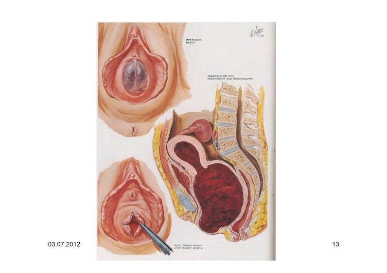 Раздвинутые створки вагины фото